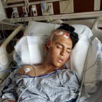 <p>The victim of Meryl Streep&#x27;s nephew is filing a civil suit and will ask the DA to prosecute it as a hate crime after he was hospitalized following a road-rage incident.</p>