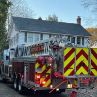 1 Person Burned During Westport House Fire