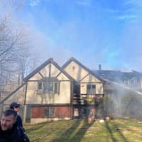 Update: Funds Come To Pound Ridge Firefighter Hurt In Blaze