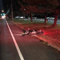 <p>A motorcyclist was hospitalized after a driver allegedly on drugs forced them off the side of the road in Airmont.</p>