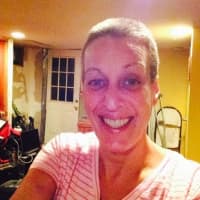 <p>Fishkill breast cancer survivor Dawn Fortis takes a selfie during treatment in 2015.</p>