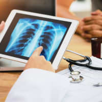 <p>NewYork-Presbyterian Hudson Valley Hospital experts explain the benefits of lung cancer screening and advances in treatment.</p>