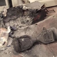 <p>The aftermath of a hoverboard fire at a home in Chappaqua, N.Y.</p>
