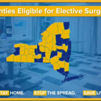 <p>A look at counties (in yellow) now cleared to resume performing elective surgeries.</p>