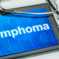 Research Provides Treatment Breakthroughs For Lymphoma