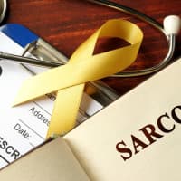 Take Your Lumps And Bumps Seriously: Know The Signs And Symptoms Of Sarcoma