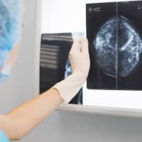 Can Breast Cancer Be Prevented?