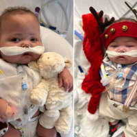 Albany 7-Month-Old Who Died Of Rare Heart Defect Was 'So Amazing, Strong,' Mom Says