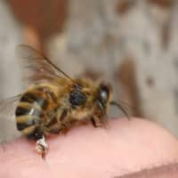 <p>A 30-year-old man stung by a bee suffered an allergic reaction Tuesday at a park in Ardsley.</p>