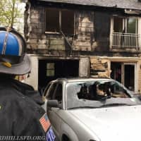 <p>A car fire swiftly spread to a Mount Kisco home that was under renovation.</p>