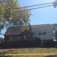 <p>A Yonkers man is in the hospital after an apparent self-inflicted gunshot wound, according to police. Above, the home at 26 Rugby Road.</p>