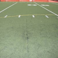 <p>Exposed seams have created a safety concern on the synthetic turf field at the Eastchester High School.</p>