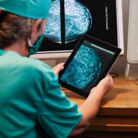 <p>White Plains Hospital is one of the first medical centers to adopt 3-D mammography technology. </p>
