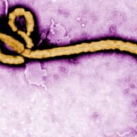 <p>The Ebola virus</p>