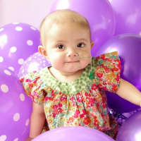 <p>Leni, age 1-and-a-half, is battling leukemia.</p>