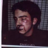<p>Andrew Caspi was 17 when this photo was taken after his arrest in December 2004 by Rye police.</p>