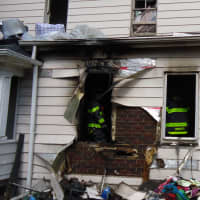 <p>Fire officials said nobody else was injured in the fire on Ely Avenue.</p>
