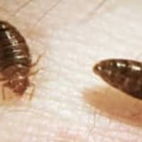 <p>Bed bugs were reportedly discovered in a Mount Vernon police squad car.</p>