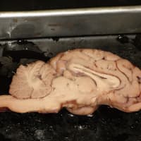 <p>Working in groups of three and four, Fox Lane students examined and dissected a sheep brain.</p>