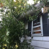<p>A tree injured a woman and did significant damage to her home Thursday morning.</p>