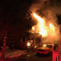 <p>Three people were severely burned in a Beacon fire.</p>
