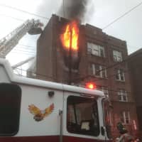 <p>The fire broke out late Sunday afternoon at the four-story apartment building in Yonkers.</p>