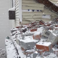 <p>One resident was displaced after the facade of an apartment complex came apart.</p>