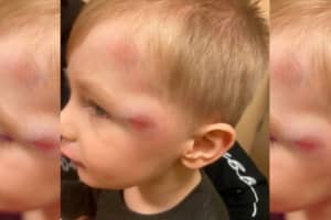 4-Year-Old 'Almost Died' In Halloween Hit-Run, Pennsylvania Mom Says