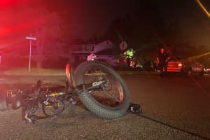 Bicyclist Seriously Injured After Being Struck By Vehicle In Area