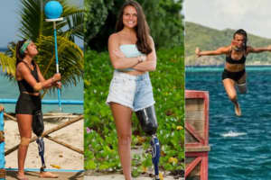 UMass Lowell Alum Reflects On Being First Above Knee Amputee On 'Survivor'