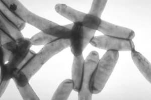 Legionnaires’ Disease Cases Reported In Nassau County
