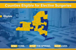 COVID-19: 35 NY Counties Now Cleared To Have Hospitals Resume Elective Surgery