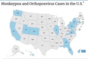 CDC Raises Monkeypox Alert Level As Number Of US Cases Rises