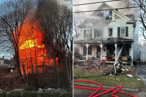 74-Year-Old Dies In Capital Region House Fire, Explosion That Nearly Killed Firefighter