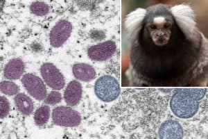WHO Issues Warning After Reports Of Fatal Attacks On Monkeys Amid Monkeypox Outbreak