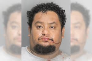 Man Assaults East Meadow Nurse Caring For Him, Police Say