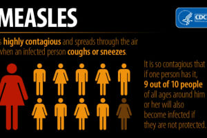 New York City Declares Measles Public Health Emergency In Select ZIP Codes