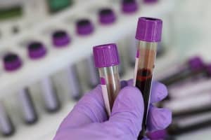 Blood Type Doesn't Increase Or Reduce Risk Of Contracting COVID, Studies Find