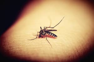 Mosquitoes Carrying West Nile Virus Found In Rye, Mamaroneck: Here's How To Protect Yourself