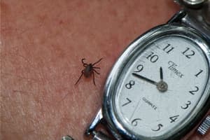 Fairfield County's Third Case Of Tick-Borne Powassan Virus Reported In Ridgefield