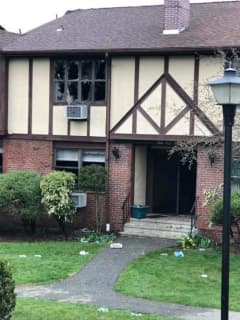 Six Injured, One Severely, In Rockland Apartment Fire