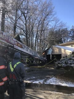 One Hospitalized After Fire Breaks Out In Area Home