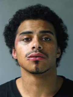 North Salem Man Accused Of Stabbing, Choking Victim During Assault