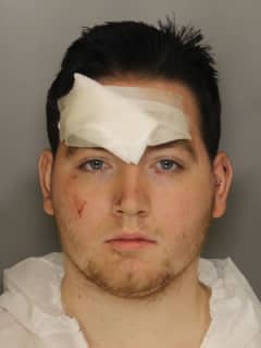 ChesCo Thief Stabbed Officer In Head After Being Let Off Easy, Authorities Say