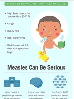 European Tourists' Visit To Area Prompts Measles Warning