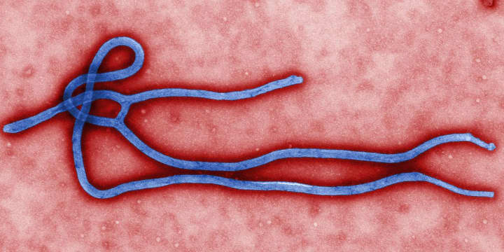 The Center for Disease Control has released important information regarding the Ebola virus. 