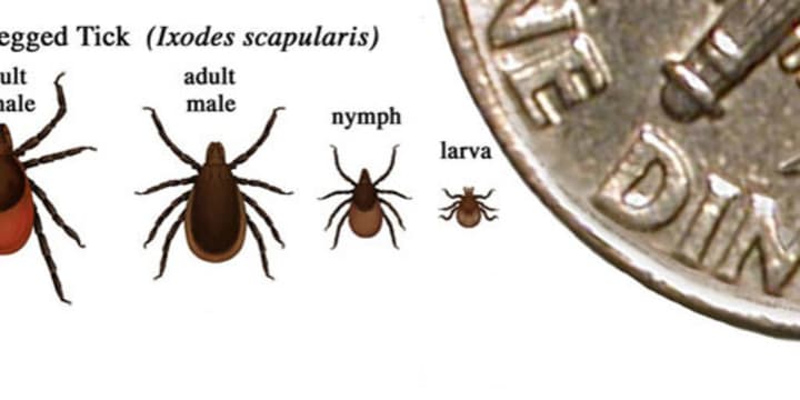 Experts are trying to determine why Lyme Disease has extended impacts on certain patients. 