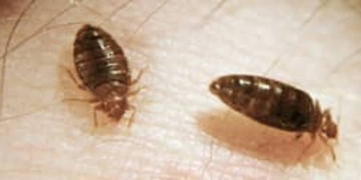 Bed bugs were reportedly discovered in a Mount Vernon police squad car.