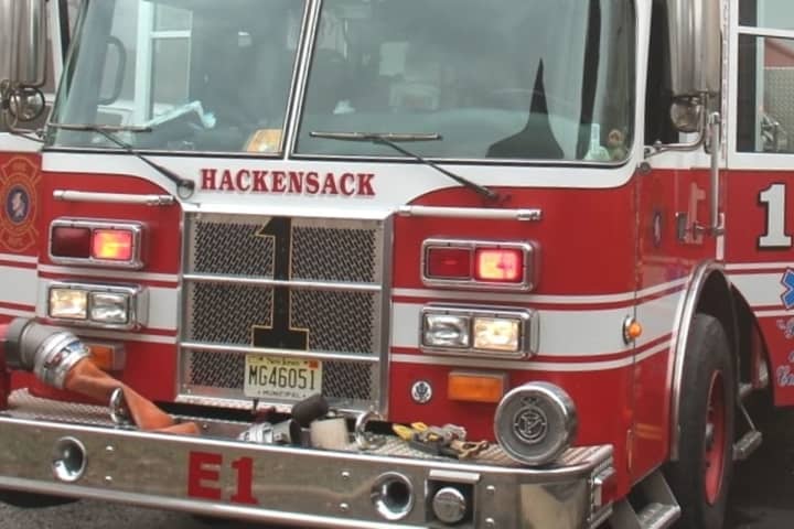 Cooking Accident Sends Hackensack Woman To Hospital