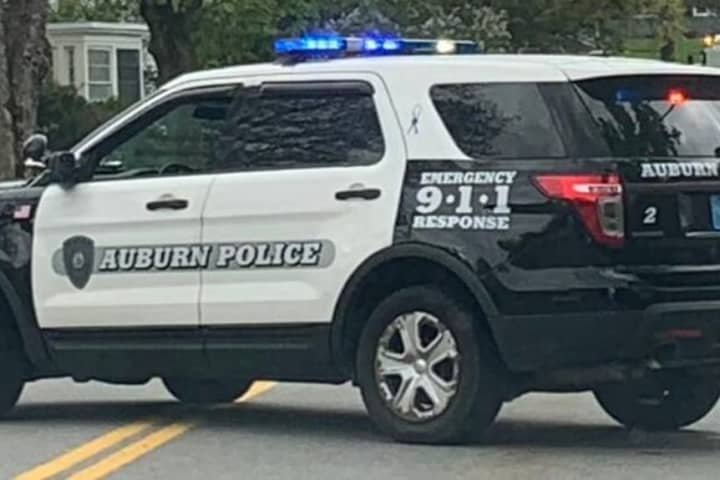 Kid Hit By Car In Auburn While Going To School